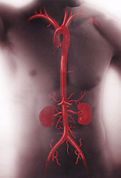 Imagem - cirurgia vascular