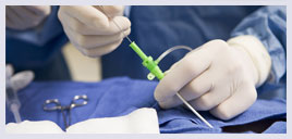 Cirurgia de varizes a laser