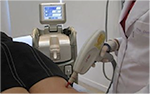 Imagem: Procedimentos venosos - Laser trandérmico para telangiectasias – vasinhos
