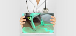 Tratamento de varizes a laser