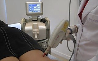 Imagem - Laser transdérmico